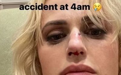 Rebel Wilson : Victime d’un accident choquant sur le plateau de tournage !