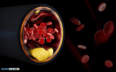 Problèmes de circulation sanguine ? Découvrez le pouvoir naturel du persil pour vous aider à améliorer votre santé !